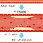 血管の状態