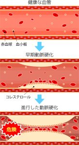 血管の状態